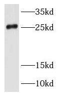 RAB35 antibody|RAB35抗体