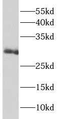 IL22RA2 antibody|IL22RA2抗体 FNa