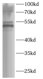CHIA antibody|CHIA抗体 FNab10104
