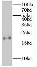 HMGA2 antibody|HMGA2抗体