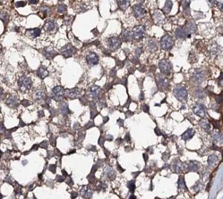 ATP9A antibody|ATP9A抗体