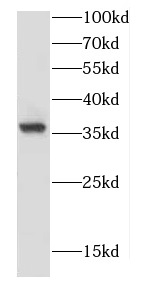 CAMLG antibody|CAMLG抗体