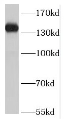 MST1R antibody|MST1R抗体