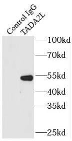 SPAG6 antibody|SPAG6抗体