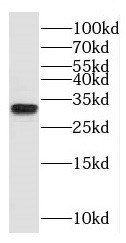 PSMA1 antibody|PSMA1抗体