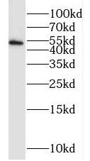 PPP2R3C antibody|PPP2R3C抗体