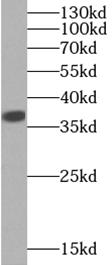 LDHA-Specific antibody|LDHA抗体
