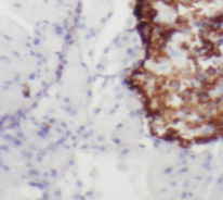 RAB3A-specific antibody|RAB3A抗