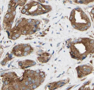 PIK3R1 antibody|PIK3R1抗体 FNab0