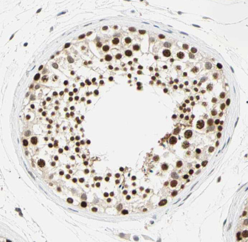 RNF17 antibody|RNF17抗体