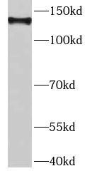DHX9 antibody|DHX9抗体