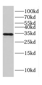 CENPO antibody|CENPO抗体