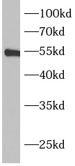 BPI antibody|BPI抗体