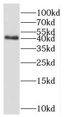 PPM1A antibody|PPM1A抗体