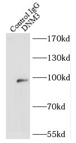 CYP26B1 antibody|CYP26B1抗体