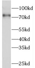 PRKCD antibody|PRKCD抗体 FNab064