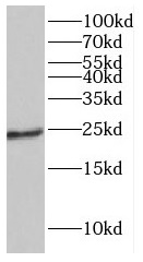 GUCA1A antibody|GUCA1A抗体