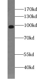 HCN2 antibody|HCN2抗体