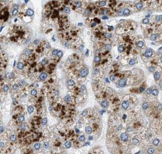 APOB antibody|APOB抗体