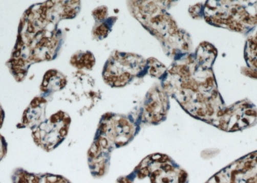 PZP antibody|PZP抗体