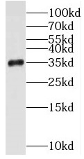 STUB1 antibody|STUB1抗体
