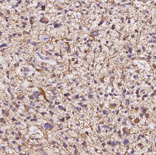 PLA2G4B antibody|PLA2G4B抗体 FNa