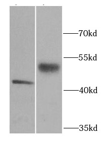 SERPINA1 antibody|SERPINA1抗体 F