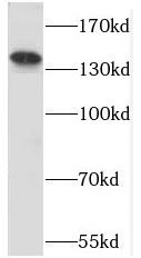 PPFIA3 antibody|PPFIA3抗体