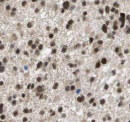 SUMO2/3 antibody|SUMO2/3抗体 FNa