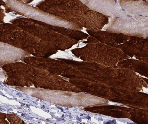 LIFR antibody|LIFR抗体