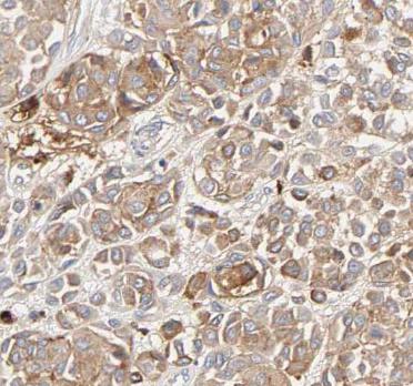 ANXA5 antibody|ANXA5抗体 FNab004