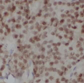 CSE1L antibody|CSE1L抗体