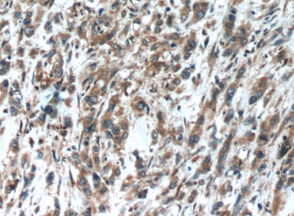 OPHN1 antibody|OPHN1抗体 FNab059