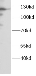 DNA2 antibody|DNA2抗体 FNab10066