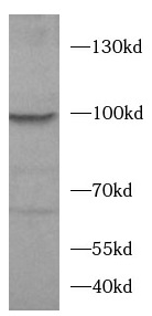 HCN1 antibody|HCN1抗体 FNab10780