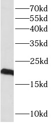 PLAAT4 antibody|PLAAT4抗体