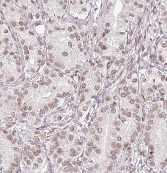 EYA2 antibody|EYA2抗体
