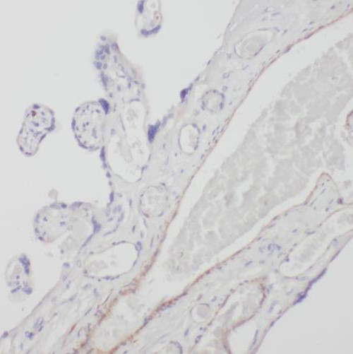 SLC18A1 antibody|SLC18A1抗体