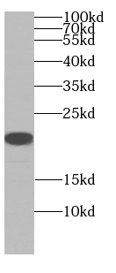 ARF5-Specific antibody|ARF5抗体
