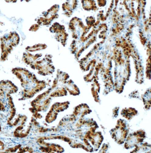 S100A13 antibody|S100A13抗体
