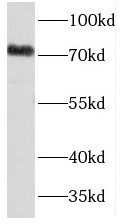 TDRD3 antibody|TDRD3抗体