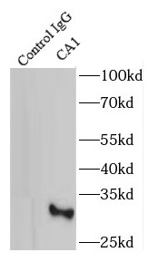 BCAP31 antibody|BCAP31抗体