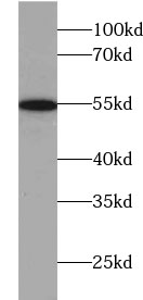 TRMT2B antibody|TRMT2B抗体