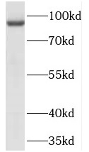 TELO2 antibody|TELO2抗体 FNab085