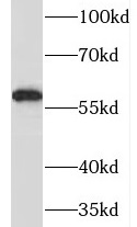MAOB antibody|MAOB抗体 FNab04971