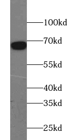 TRIM69 antibody|TRIM69抗体
