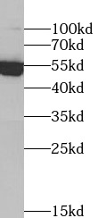 TXNRD2 antibody|TXNRD2抗体