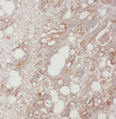 BLMH antibody|BLMH抗体