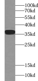 IL33 antibody|IL33抗体 FNab04272