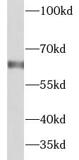 GLB1 antibody|GLB1抗体 FNab00877
